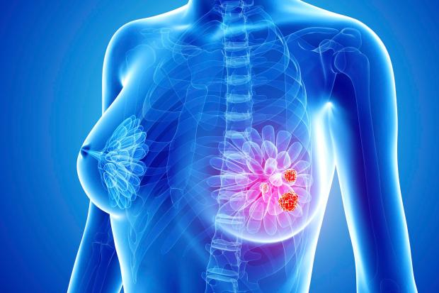 Scientists have identified 23 genes that control the spread of cancer, raising hopes of new drugs to halt the disease in its tracks