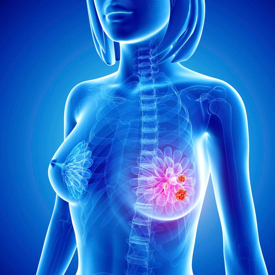 Scientists have identified 23 genes that control the spread of cancer, raising hopes of new drugs to halt the disease in its tracks