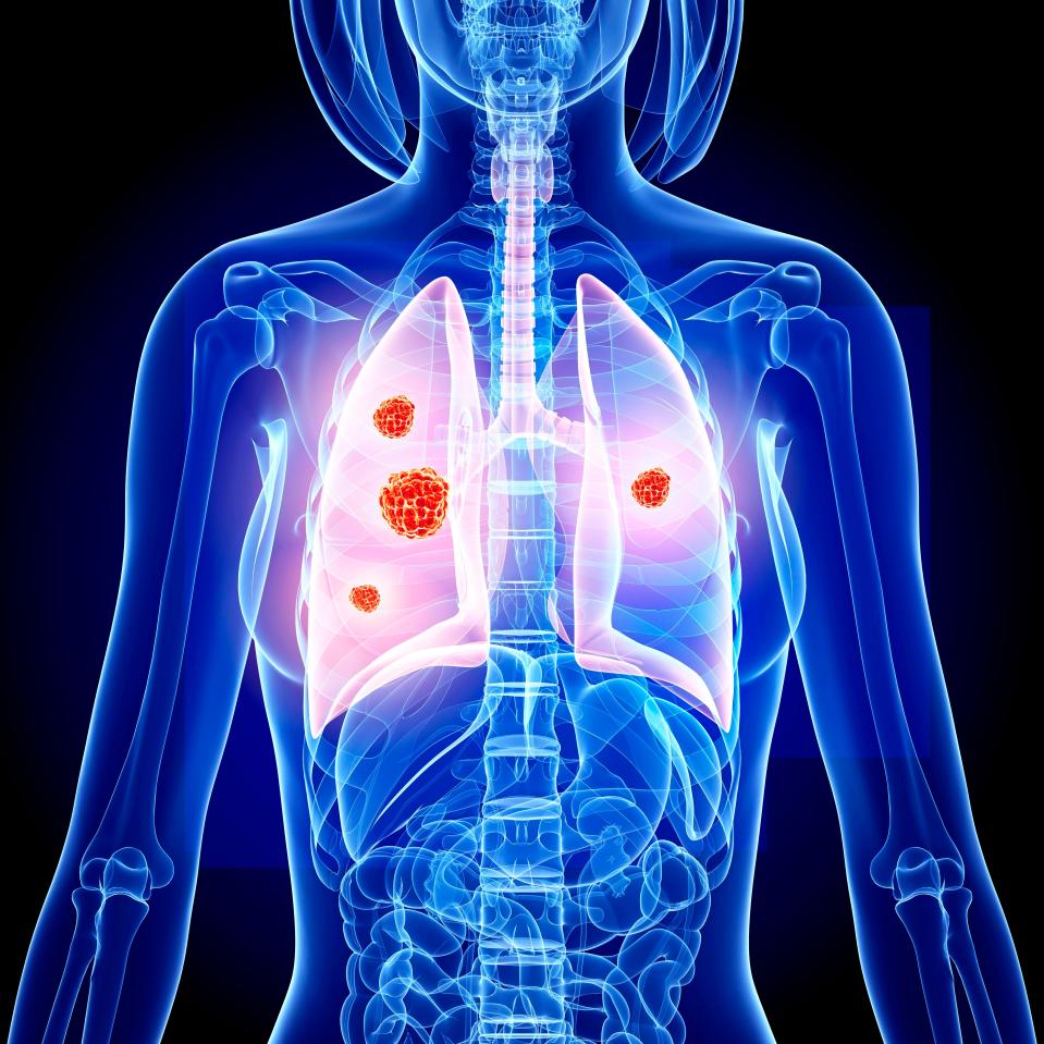 A new study has found by monitoring heart rate, skin temperature, activity and other key variables it is possible to spot the signs of infection and inflammation - indicative of diseases like cancer