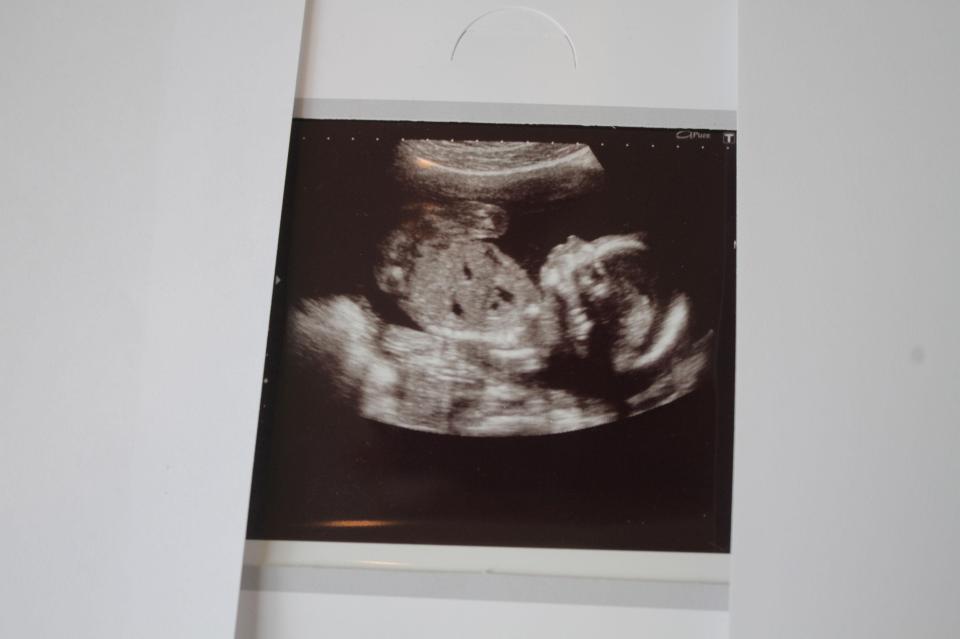 The baby is due in late spring, early summer