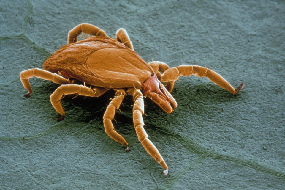 Lead researcher Professor Michael Snyder diagnosed himself with Lyme disease - carried by ticks - using seven biosensors, while taking part in his own research