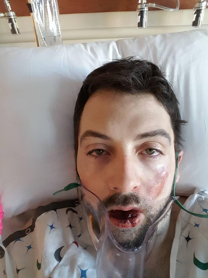 The injuries have required him to be monitored in a hospital intensive care unit 