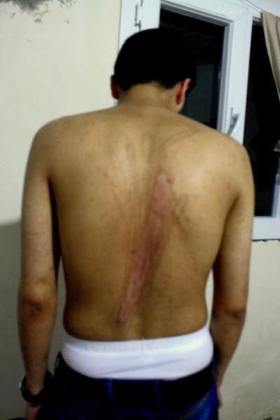 Few pictures exist of survivors of Saydnaya Prison - but those that do reveal horrendous injuries