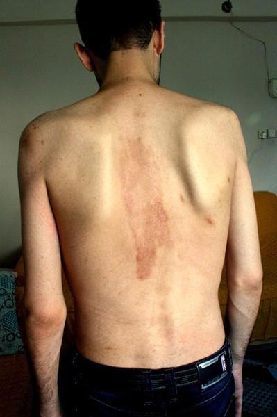 Some of the prisoners escaped with deep scars (shown)