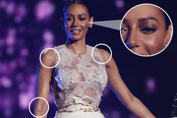 Mel B walked on to the stage that night looking battered and bruised 