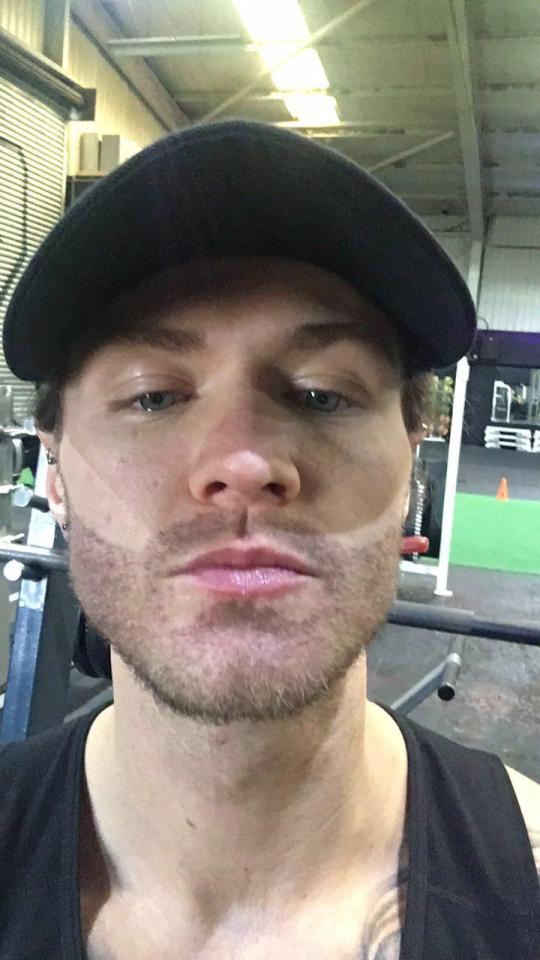  Kyle has admitted he's still not happy with his face