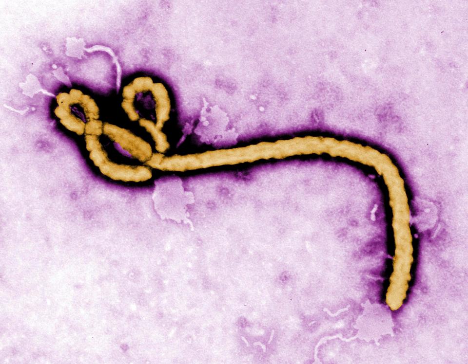 An electron micrograph file image shows an Ebola virus virion