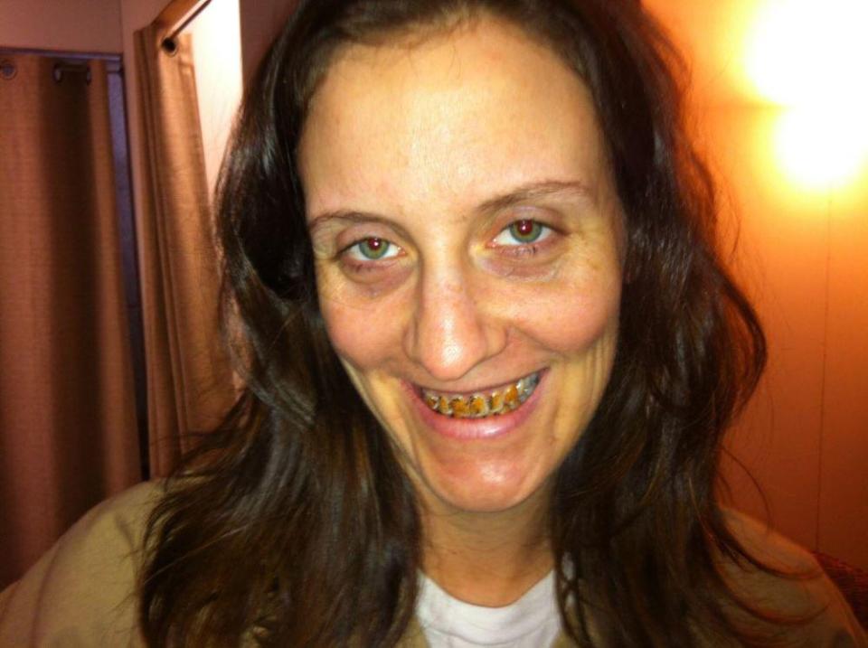  Her striking appearance is achieved by fake teeth that are painted with yellow, brown and green paint