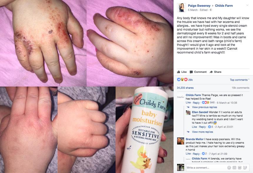 Paige Sweeny took to Facebook to share her delight at how the cream cleared up her daughter's eczema
