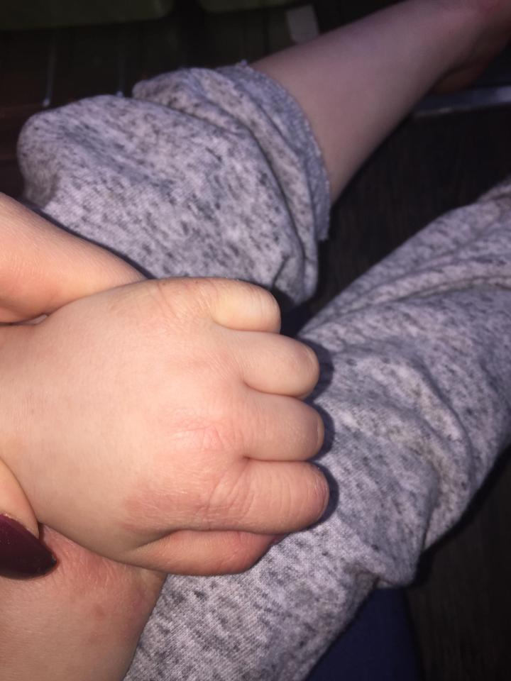 After using Childs Farm baby moisturiser Evie's hands were clear of eczema within a week, her mum claims