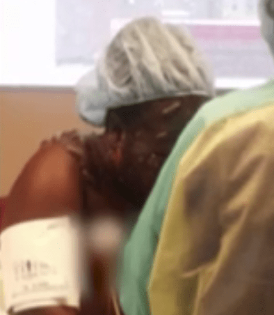 The 11-year-old was left with burns to her face chest, back and shoulders