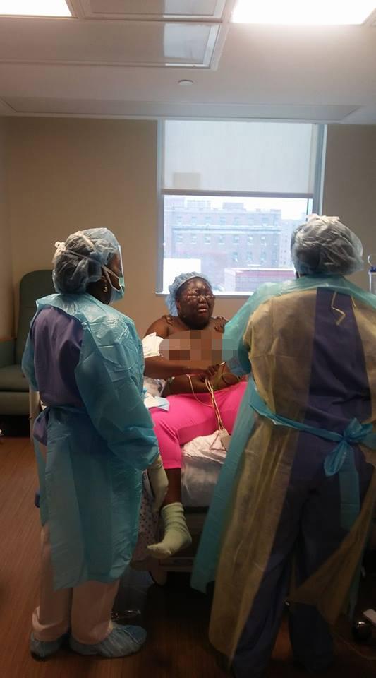  Earlier in August, Jamoneisha Merritt suffered horrific burns when her friends threw boiling water over her face