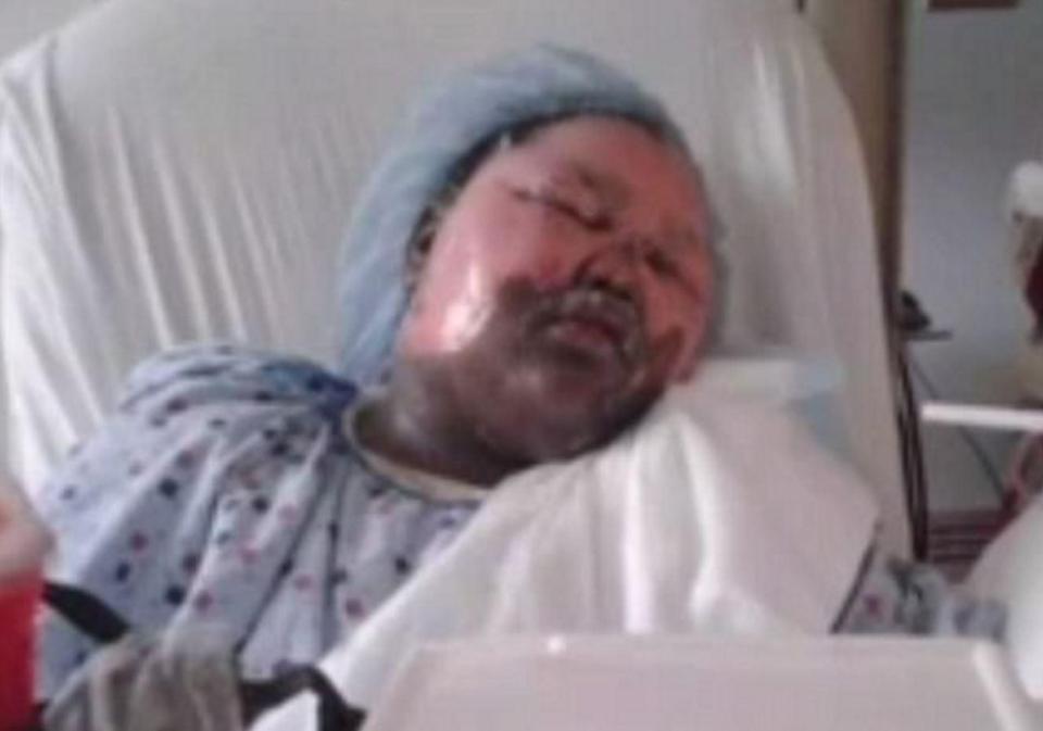  Jamoneisha Merritt, 11, suffered second-degree burns after the dangerous prank went wrong