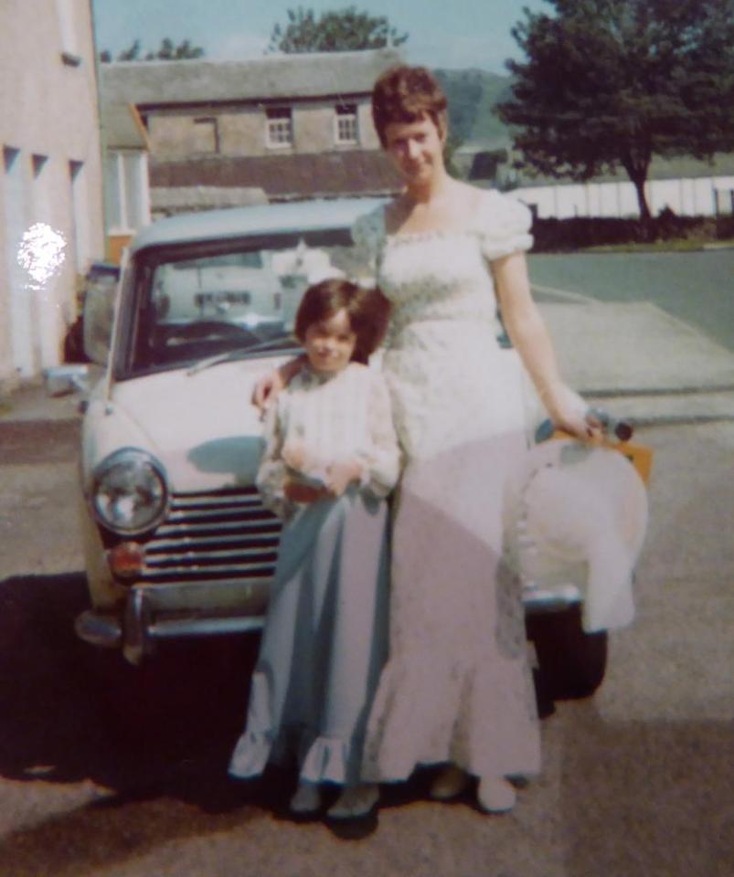 Juli-Anne was first diagnosed with eczema when she was three months old and was plagued with skin conditions when she was a child