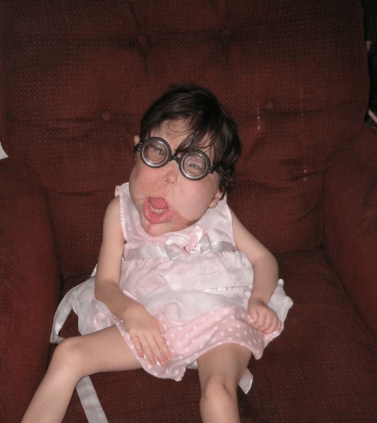 Katie has been through many operations, including brain surgery and having her tonsils removed, as well as downsizing her ear, tongue and cheeks
