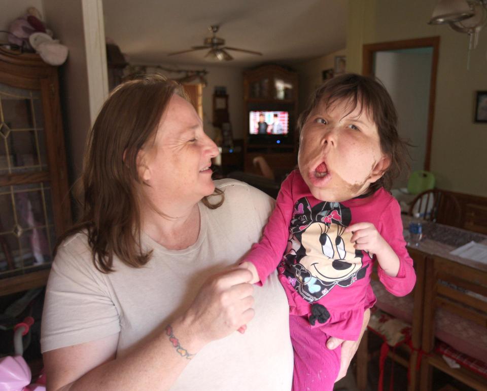 Mum Angie said doctors are so baffled they are considering naming the condition after Katie