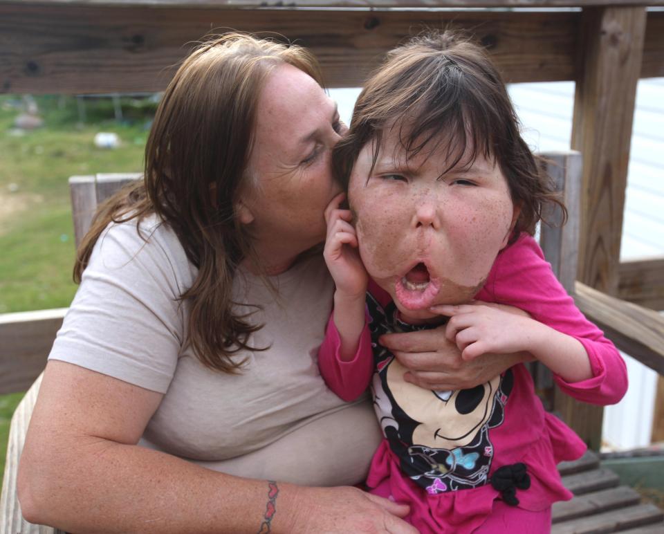 Doctors say the nine-year-old is suffering a condition so rare it has no name