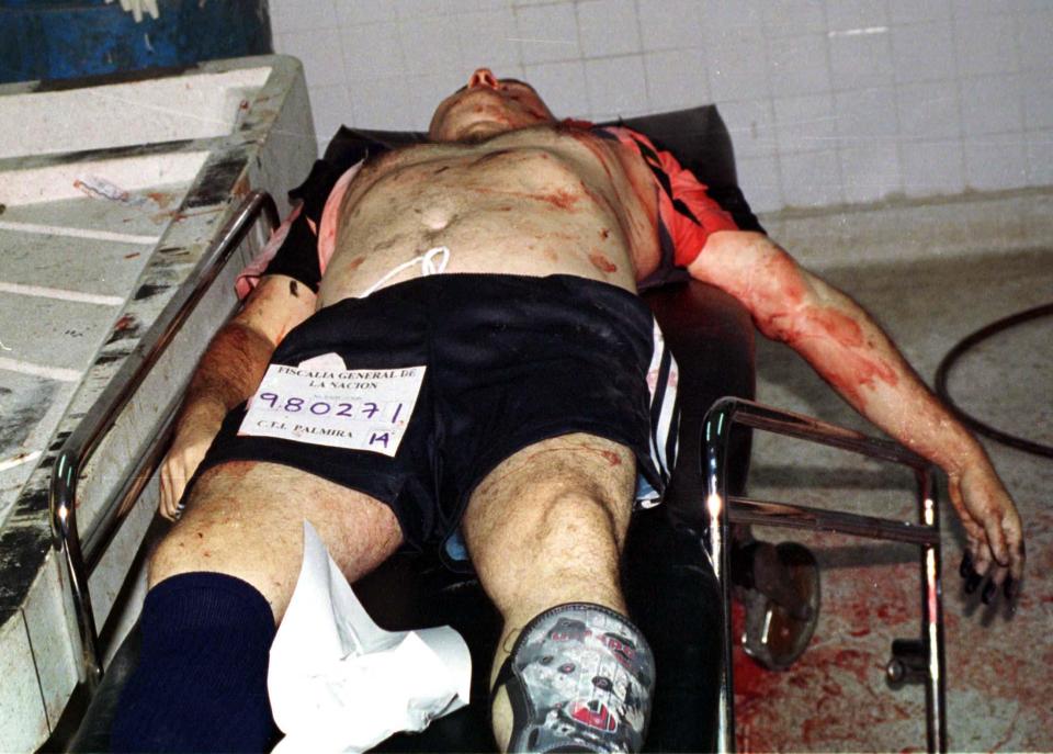  The body of slain Cali cartel drug lord Helmer Herrera lies on stretcher in a local hospital