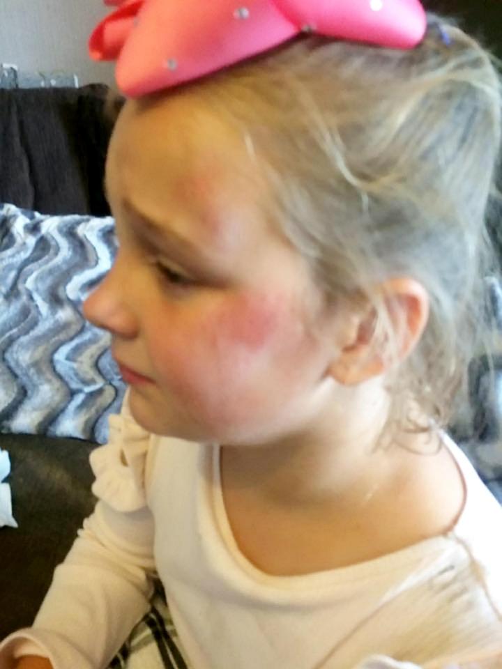  The youngster was left terrified after her attacker was wearing a clown mask