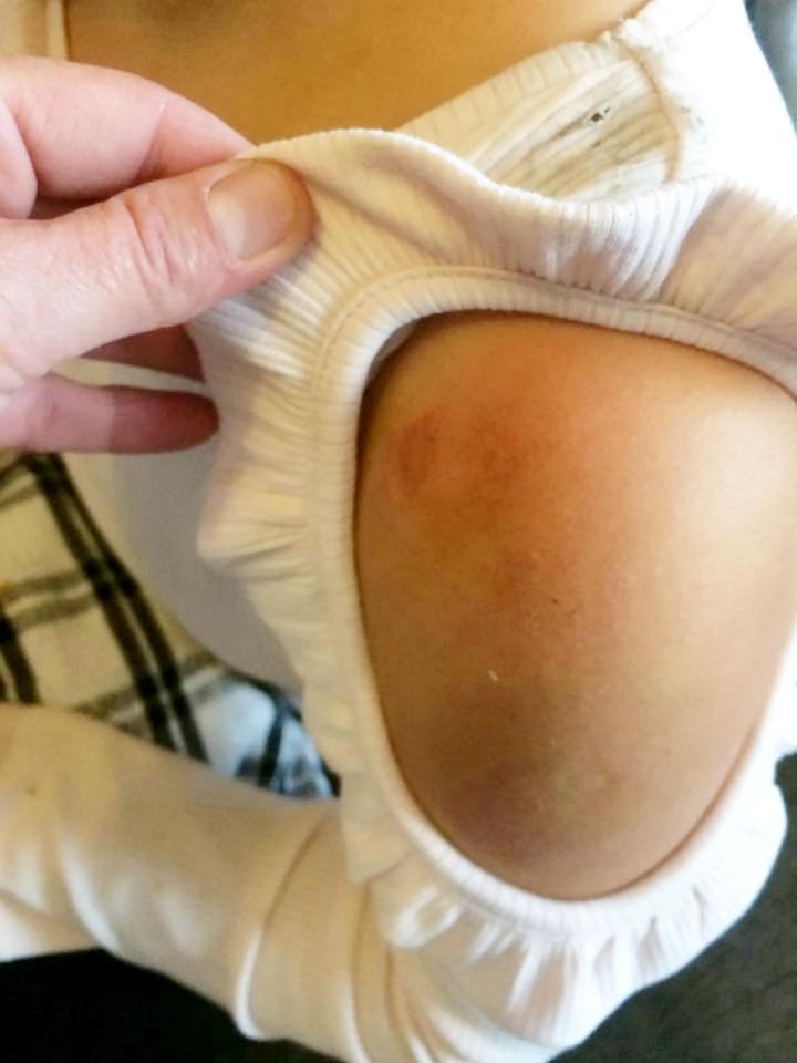  She suffered cuts and scrapes when she was shoved to the floor
