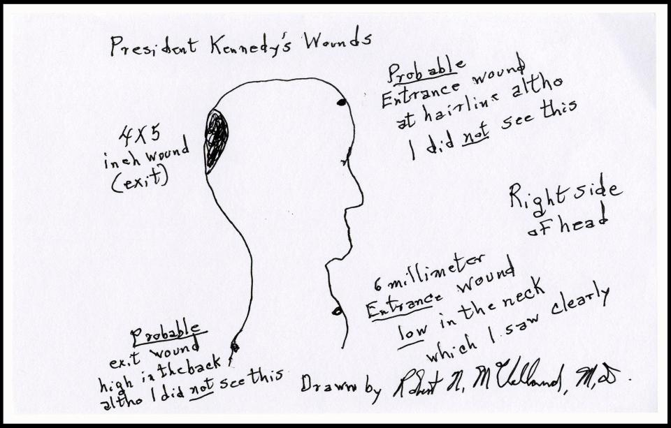 A fascinating sketch from the surgeon who tried to save President John F Kennedy has emerged for auction which suggests there were two separate shooters involved in his assassination