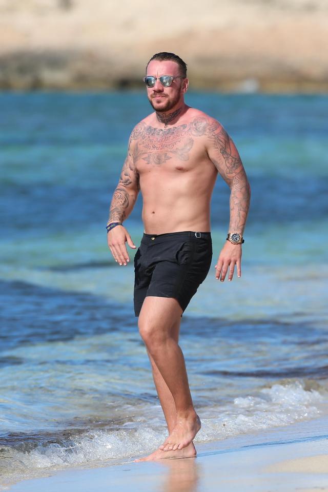  The footballer looked as if he had caught the sun