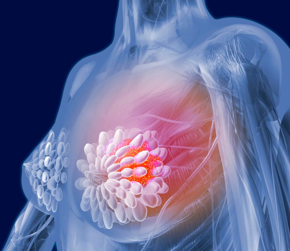 Experts estimate half a million cancer deaths every year are directly linked to booze