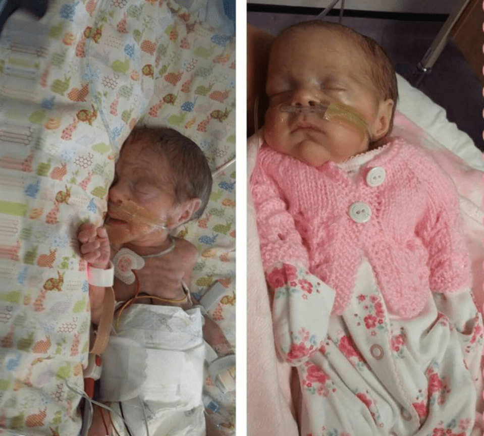 Grace pictured at three weeks old, left, and then again at ten weeks, right