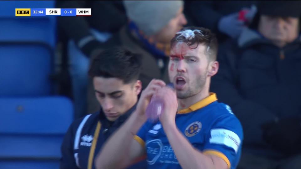  The Shrewsbury left-back was left with blood pouring down his face after the collision