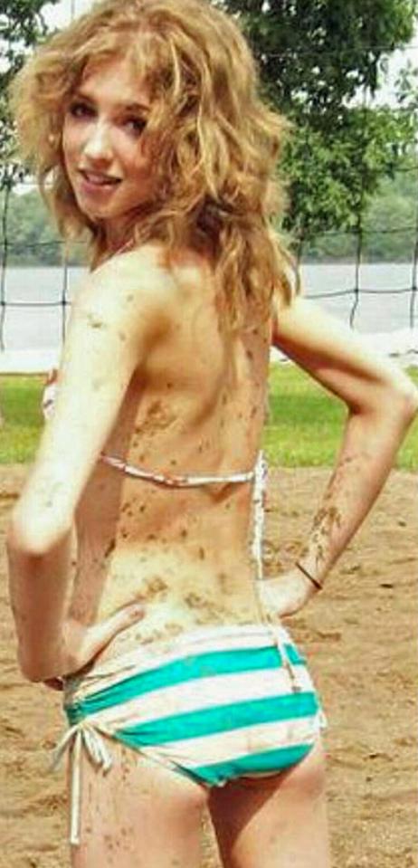  After being rejected by boys and fearing she was 'fat' due to her muscular legs, she started dieting at 15