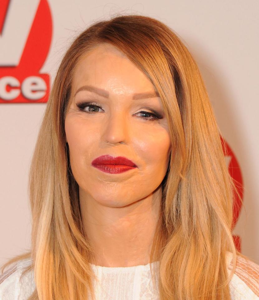 Katie Piper in 2014
