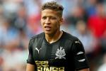 Dwight Gayle missed a penalty for Newcastle against Royal Antwerp