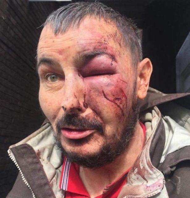  Mark Walker was set upon by a gang of six thugs as he went to get a Chinese takeaway