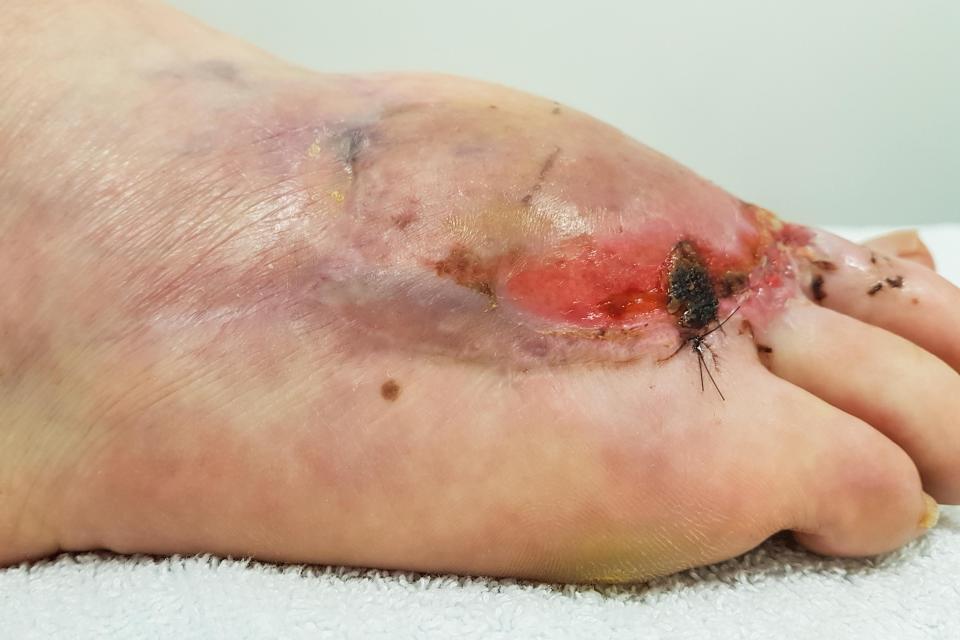 The condition is most likely to affect people over the age of 50, according to experts