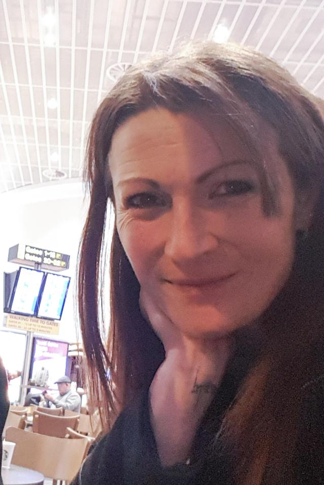 Nicola Lightfoot was left with a gaping hole in her foot after developing a rare skin condition