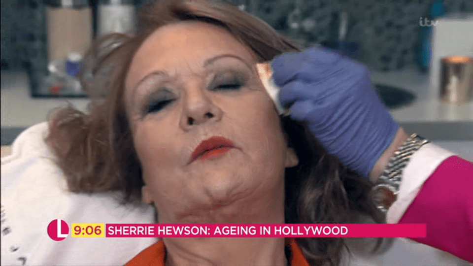  Sherrie Hewson was filmed having facial fillers on today's Lorraine as she explores ways to beat the ageing process