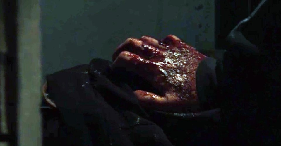 He was clutching his leg which was bleeding profusely
