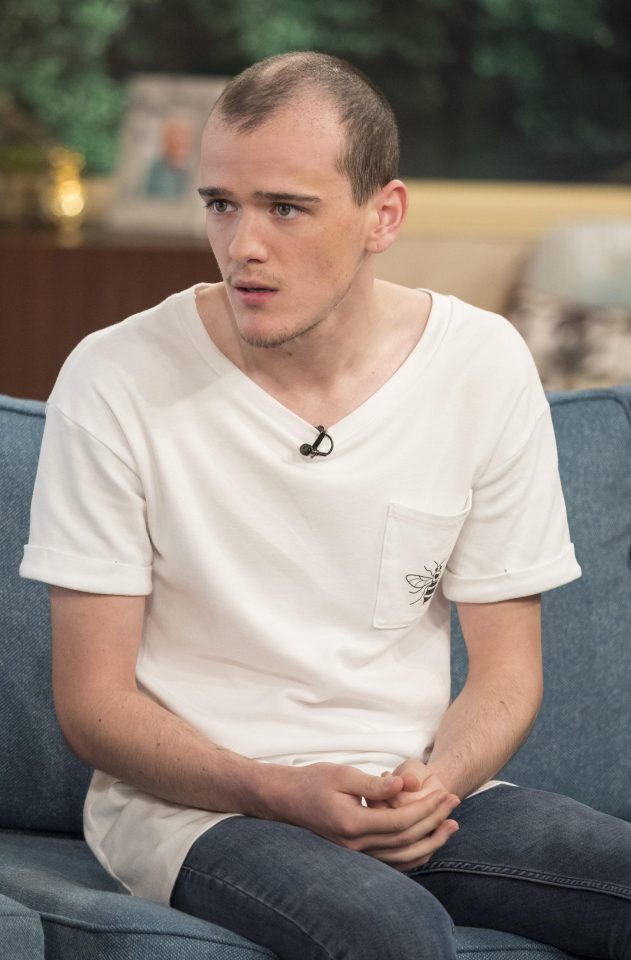  George had appeared on the show in August last year to reveal the first stage of his hair transplant