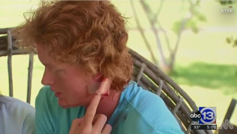  16-year-old Rome Shubert was shot in the back of the head and the bullet left by his ear. He miraculously survived the slaughter