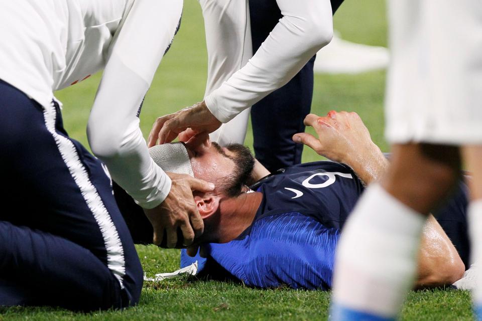  The match against the USA was stopped for five minutes as medics thoroughly checked over both players