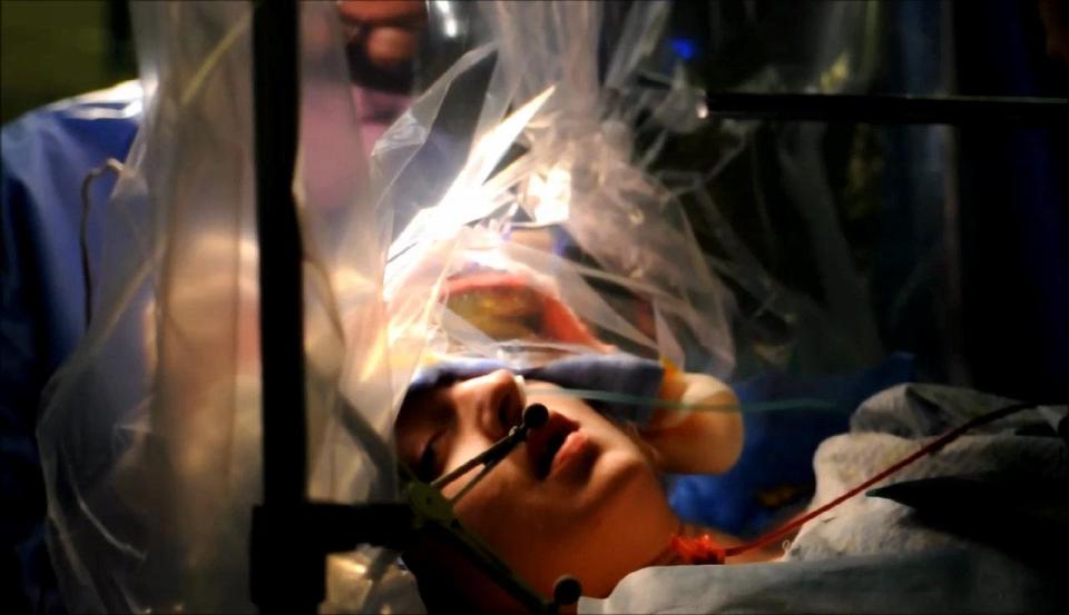  A comedian cracked jokes while having a brain tumour removed — a whole nine hours
