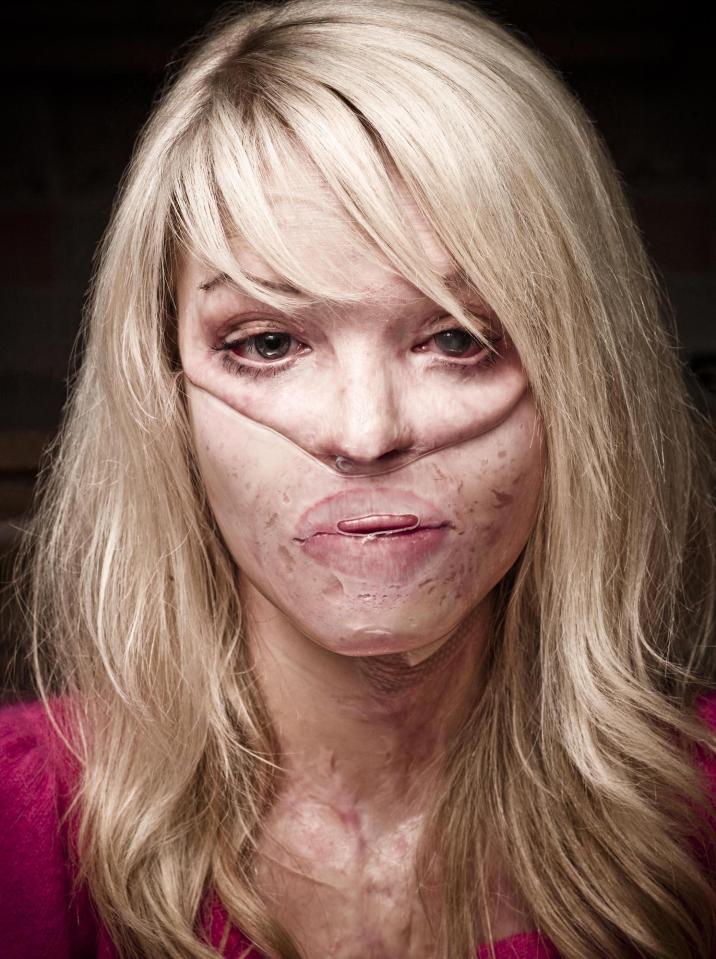  The TV star's life was changed forever in 2008 when she was the victim of an acid attack