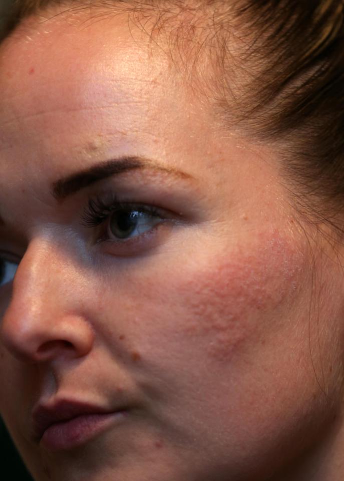  Kerry says the pain was constant and agonising