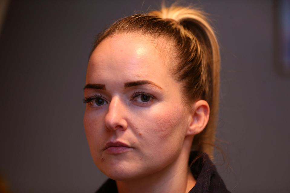  Screwfix worker Kerry fears the injury may scar