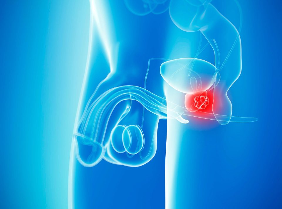 The virus was successfully tested on prostate cancer tumours and other human cancer cells