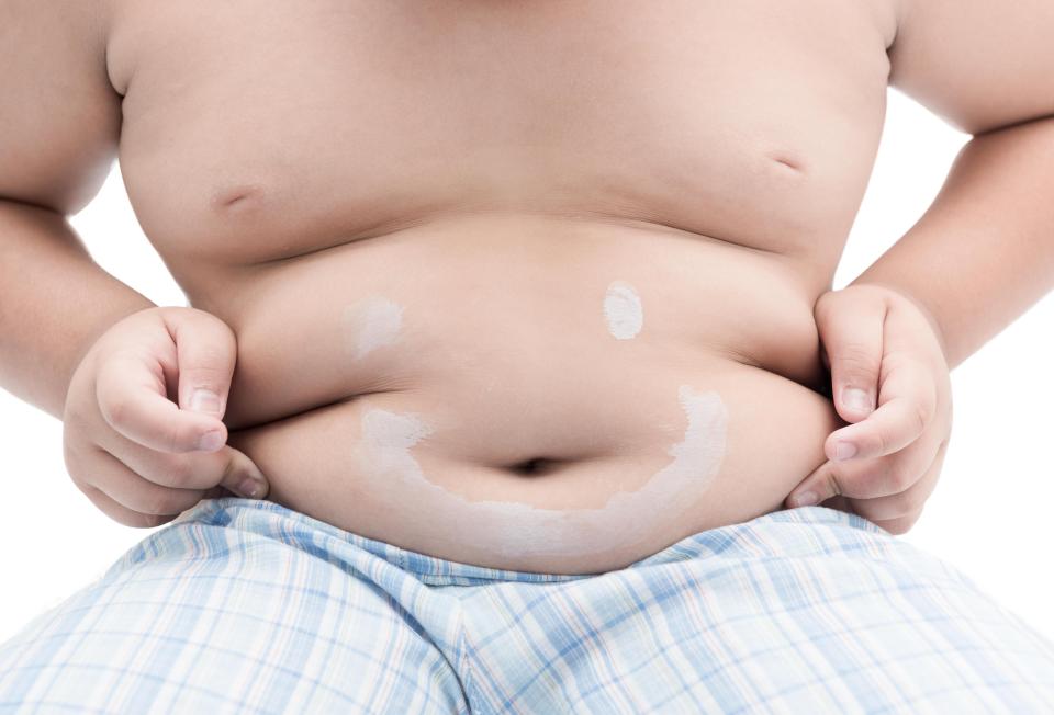  Type 2 diabetes is preventable and often caused by being overweight and inactive