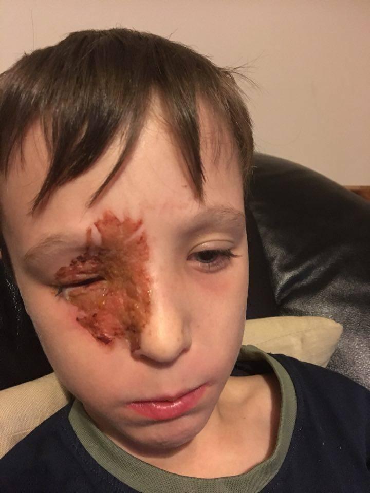  The mum of a boy who was blinded by fireworks has urged people to be careful tonight