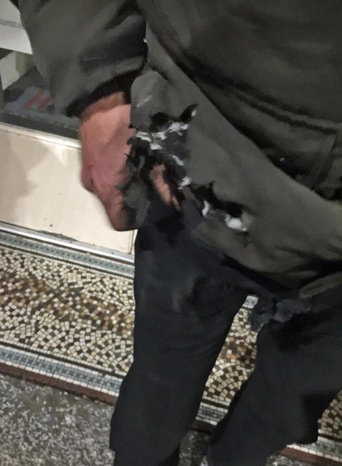  A homeless man was allegedly attacked with a firework at Liverpool's main train station