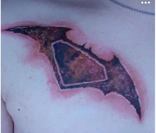  The Dark Knight Rises, painfully and with welts