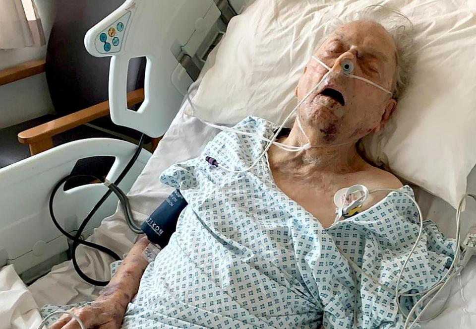  Peter Gouldstone, 98, has been fighting for his life after a brutal attack